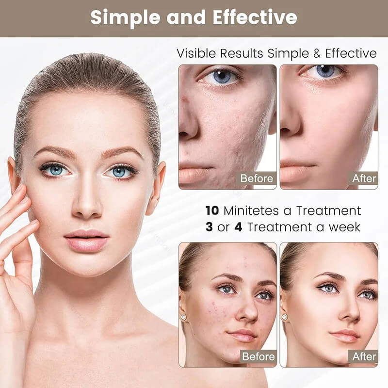 Get The Glow Light Therapy Mask