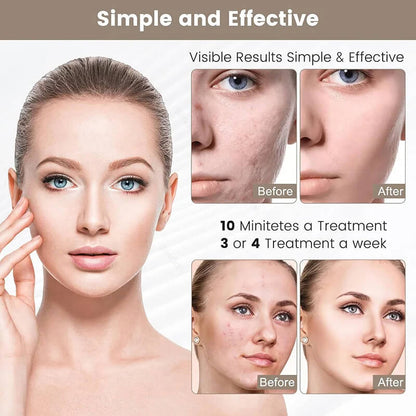 Get The Glow Light Therapy Mask